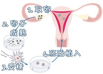 私人志愿者供卵助孕包生儿子